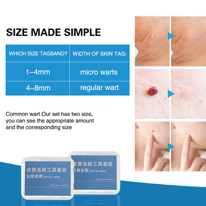 20pcs/Box Pita Penghilang Tahi - Skincare Qv ulasan dan harga
